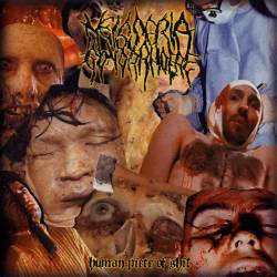 Neisseria Gonorrhoeae : Human Piece of Shit